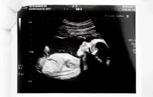 Ecografu00eda. Cru00e9dito: Dominio Pu00fablico. 