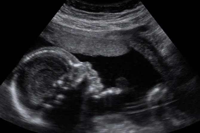 Miles de personas pedirán al Gobierno incluir ecografía en información previa al aborto