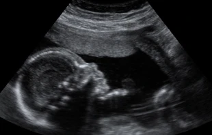 Imagen referencial / Cru00e9dito: Flickr Miss Mac (CC-BY-NC-SA-2.0) 