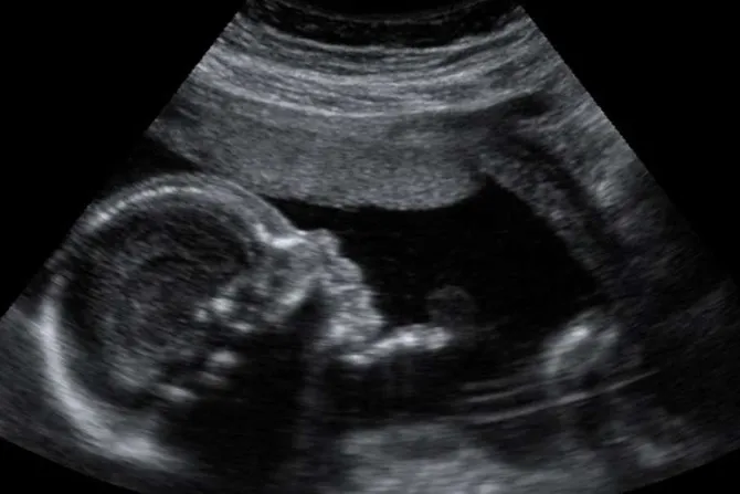 En Sudáfrica grupos abortistas no pueden encontrar médicos dispuestos a realizar abortos