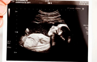 Imagen referencial. Créditos: Pixabay 