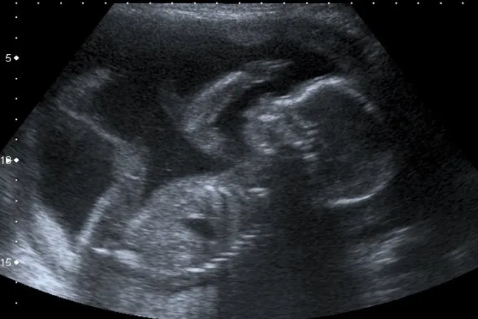 ¿Existe legalmente una persona antes de nacer? Responde una experta chilena