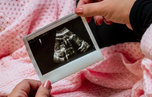 Imagen referencial. Cru00e9dito: Unsplash. 