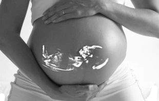 Embarazada / Foto: Pixabay (Dominio Pu00fablico) 