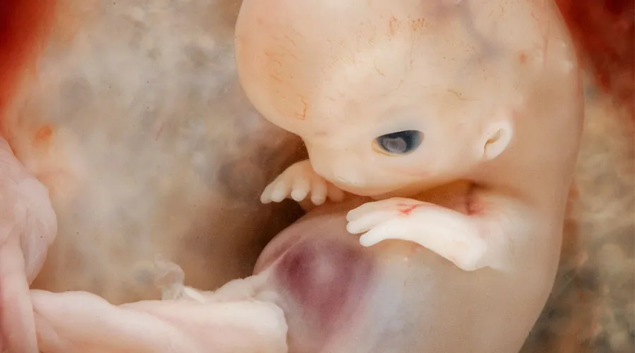 Embrión de 7 a 8 semanas. Foto: Steven O'Connor, M.D., Houston Texas.?w=200&h=150