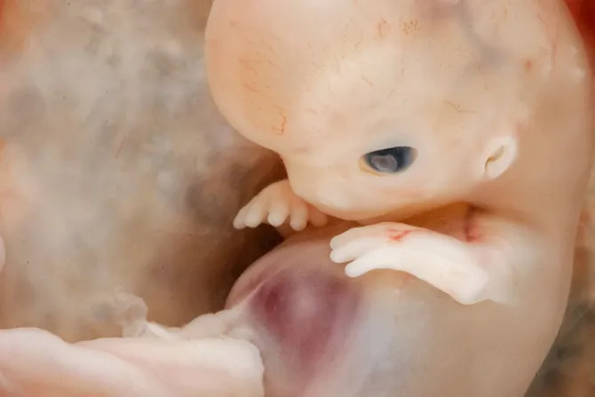 Estas impactantes imágenes demuestran que la vida humana comienza en la concepción [FOTOS]