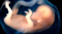 Embrión de 9 a 10 semanas de gestación / Foto: Flickr Lunar Caustic CC_BY_SA_20