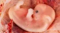 Embrión humano de 9 Semanas / Crédito: Wikipedia Ed Uthman (CC-BY-2.0)