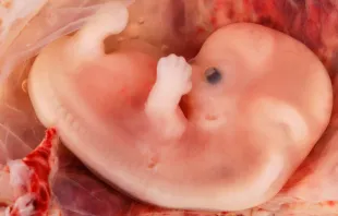 Embrión humano de 9 Semanas / Crédito: Wikipedia Ed Uthman (CC-BY-2.0) 