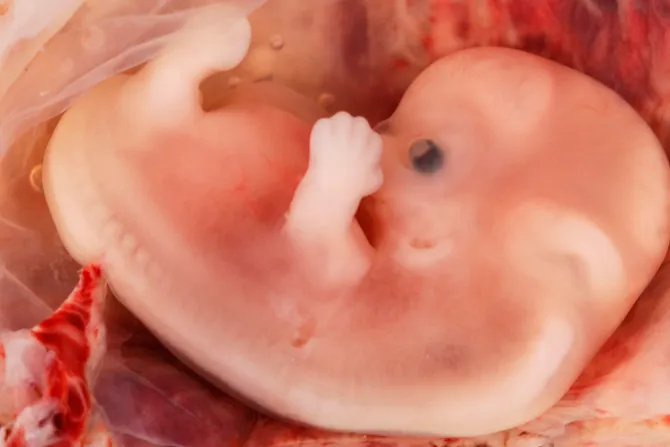 Exigen a Pepsi no usar restos de bebés eliminados por aborto