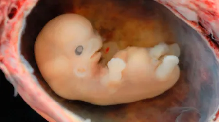 Obispos de Costa Rica recuerdan que “el embrión humano es persona humana”