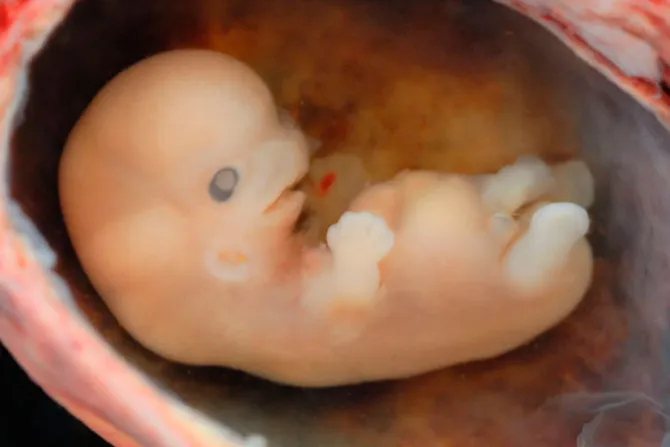 Obispos de Costa Rica recuerdan que “el embrión humano es persona humana”