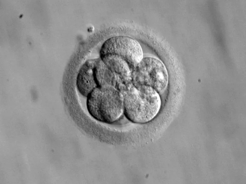 Embrión humano. Foto: Wikimedia Commons?w=200&h=150
