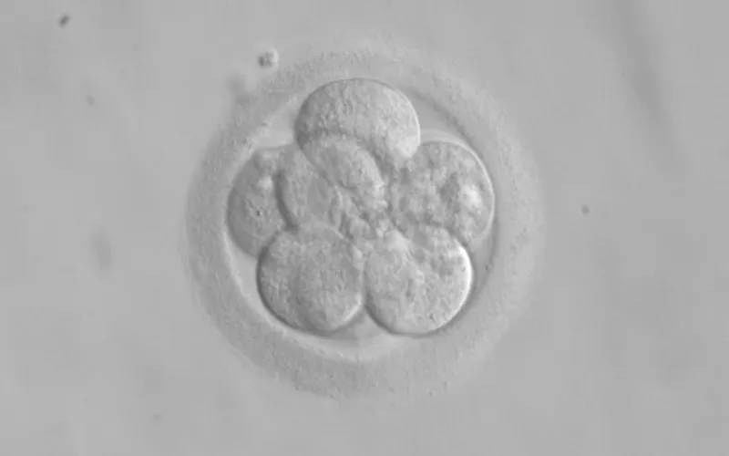 Embrión humano. Foto: Wikimedia Commons?w=200&h=150