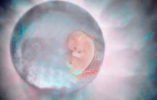 Imagen referencial / Embriu00f3n humano. Foto: Flickr de Firstbrook Just Click 100 (CC BY-NC 2.0). 