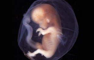 Embrion / Flickr de Lunar Caustic (CC-BY-SA-2.0)  