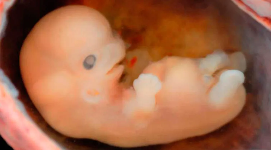 Embrión de 6 a 7 semanas / Crédito: Steven O'Connor, M.D., Houston Texas.
