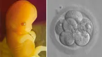 Embrión de 7 semanas y embrión de 8 células / Fotos: Dominio Público 