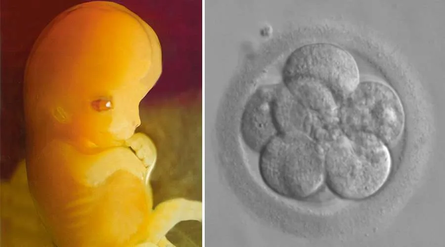 Embrión de 7 semanas y embrión de 8 células. Crédito: Dominio Público