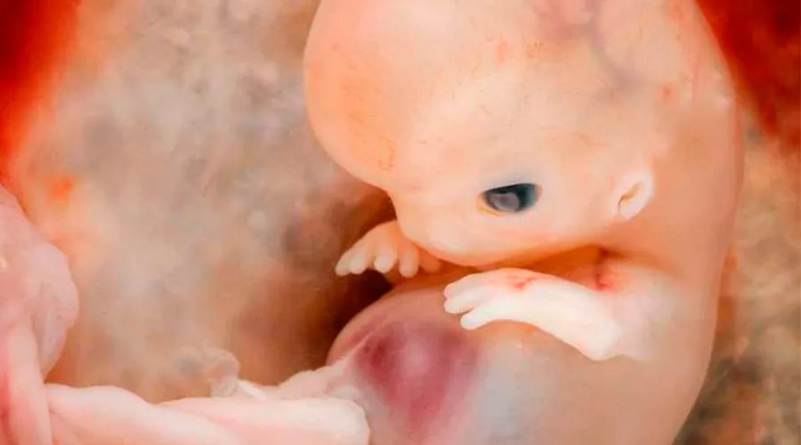 Embrión de 7 a 8 semanas / Crédito: Steven O'Connor, M.D., Houston Texas