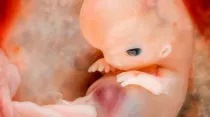 Embrión de 7 a 8 semanas / Crédito: Steven O'Connor, M.D., Houston Texas