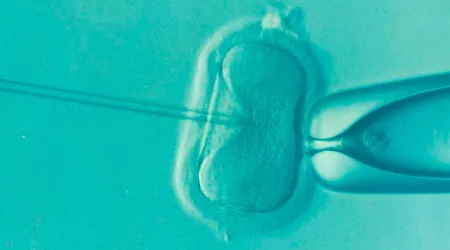 Crean embriones con células de humanos y ovejas: ¿Qué dice la bioética?