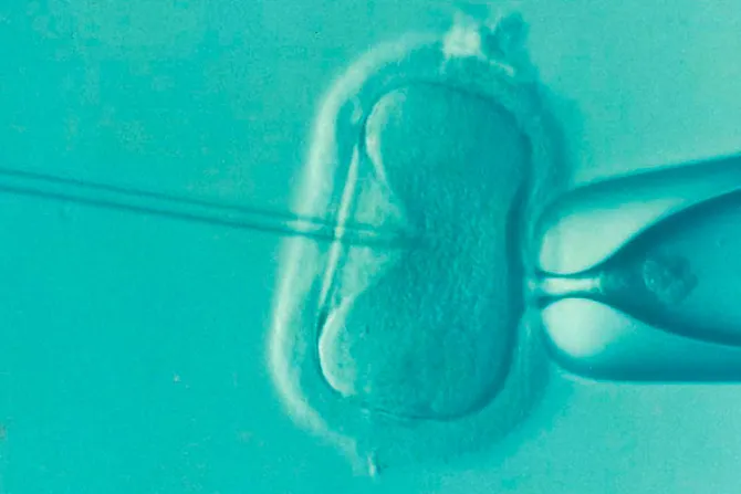 Crean embriones con células de humanos y ovejas: ¿Qué dice la bioética?