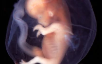 Foto Flickr Lunar Caustic (CC-BY-SA-2.0)