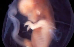 Bebu00e9 de entre 9 y 10 semanas de gestaciu00f3n. Cru00e9dito: lunar caustic (CC BY-SA 2.0). 