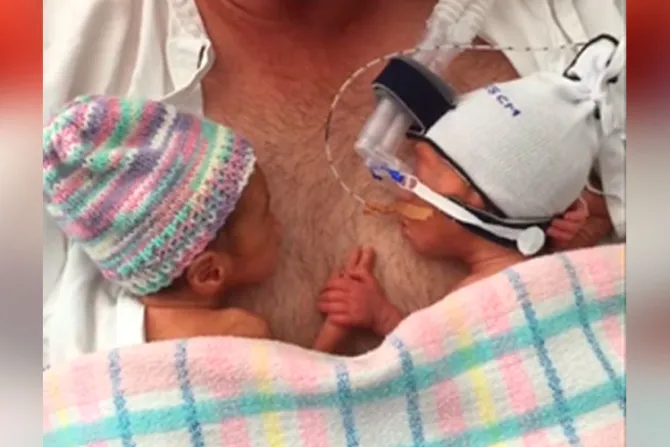 VIDEO: Lo que hacen estos gemelos prematuros de 28 semanas conmueve a Internet