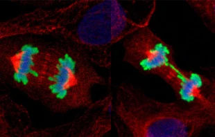 Imagen de la investigaciu00f3n. Foto: Nature / Hospital Bambino Gesu00f9 