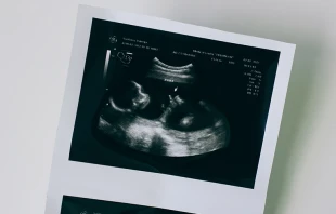 Imagen referencial. Cru00e9dito: Foto de Valeriia Svietlova / Pexels 