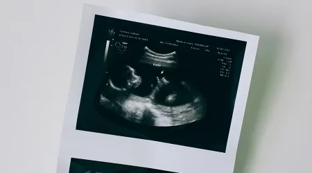 Madres que quieran abortar en Hungría deberán escuchar los latidos de su bebé