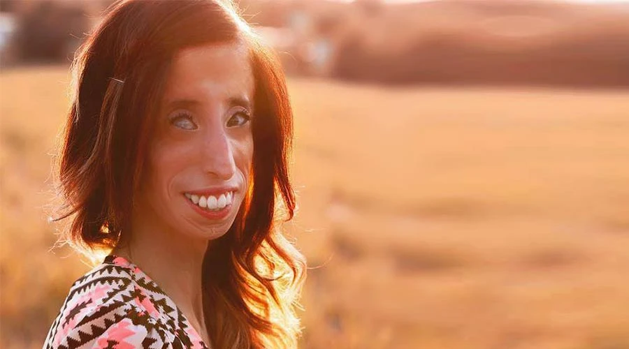 Lizzie Velasquez. Foto: Facebook oficial.?w=200&h=150