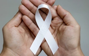 Imagen referencial. Cru00e9dito: Lais Monteiro/Shutterstock 