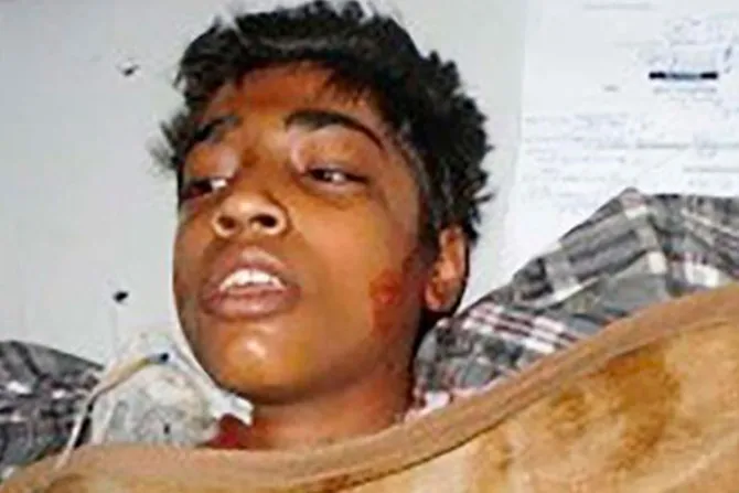 Pakistán: Muere adolescente al que prendieron fuego por decir “soy cristiano”