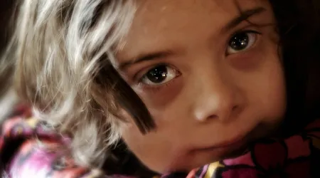 Estudio revela genocidio de niños con Síndrome de Down debido al aborto en España