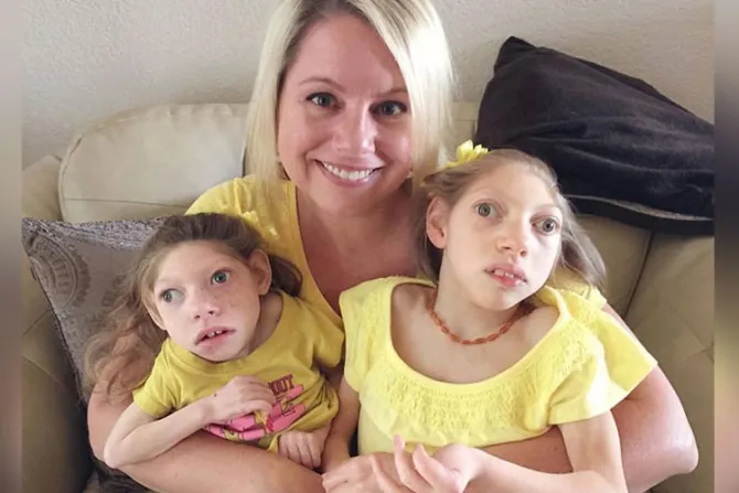 “Cada día con nuestras hijas es un regalo”, dice madre de dos niñas con microcefalia