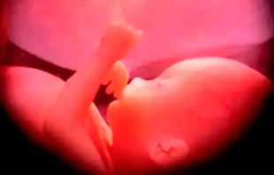 Un bebu00e9 por nacer. Cru00e9dito: Ivon19 (Wikipedia - CC-BY-SA-4.0) 