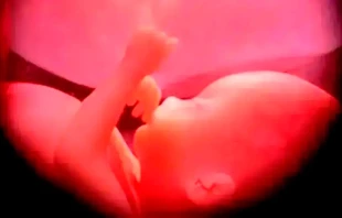 Imagen referencial. Cru00e9dito: Wikipedia 