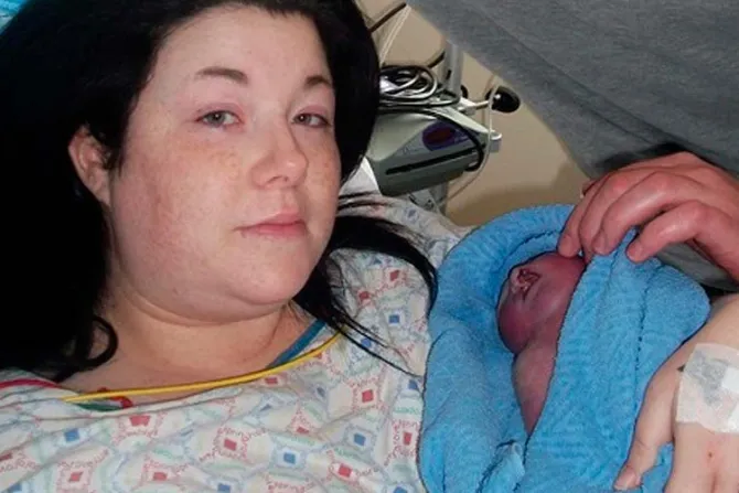 Madre embarazada de gemelas rechazó abortar a la más enferma: Su vida tiene un propósito