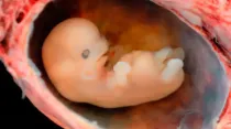 Embrión de 6 a 7 semanas. Foto: Steven O'Connor, M.D., Houston Texas.