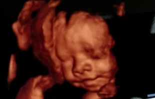 Imagen referencial. Cru00e9dito: David Ramos / ACI Prensa. 