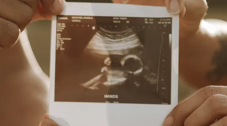 EEUU: Ley que exigía ultrasonido antes de someterse a un aborto será reanudada en Indiana