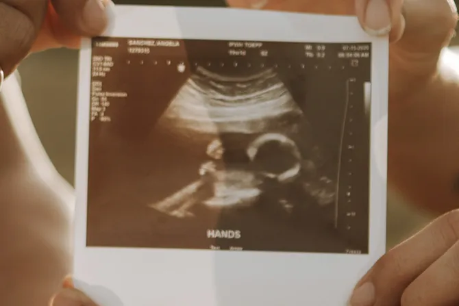 EEUU: Ley que exigía ultrasonido antes de someterse a un aborto será reanudada en Indiana