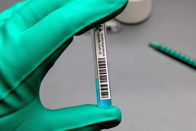 Gravedad de la pandemia justifica el uso de vacunas contra COVID-19, aclaran obispos