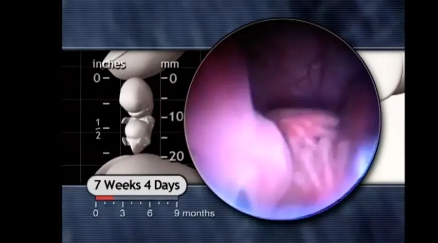 VIRAL: Video prueba que embrión de 7 semanas es un ser humano y no un "cúmulo de células"