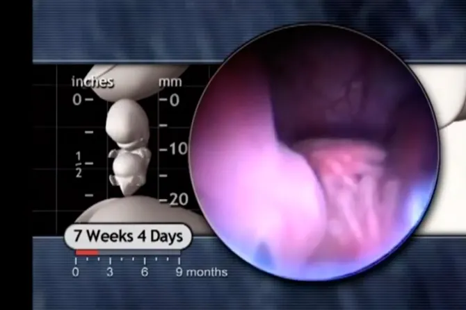 VIRAL: Video prueba que embrión de 7 semanas es un ser humano y no un "cúmulo de células"