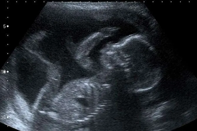 No reconocer derecho a la vida del embrión es una terrible arbitrariedad, advierte obispo