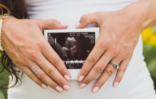 Foto referencial. Cru00e9dito: Unsplash 